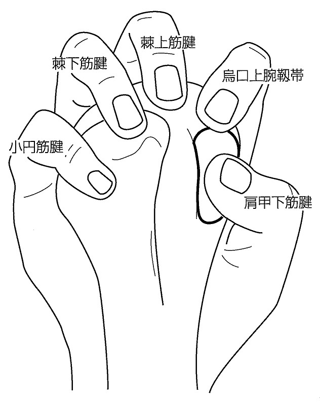 棘上筋腱の停止部