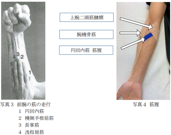 前腕の筋の走行・筋腹